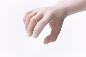 インプラント治療をしたいときには